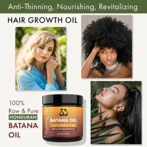 Sunny Isle 100% Raw and Pure Batana Oil 4oz